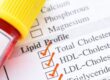 Cholesterol markers on blood test