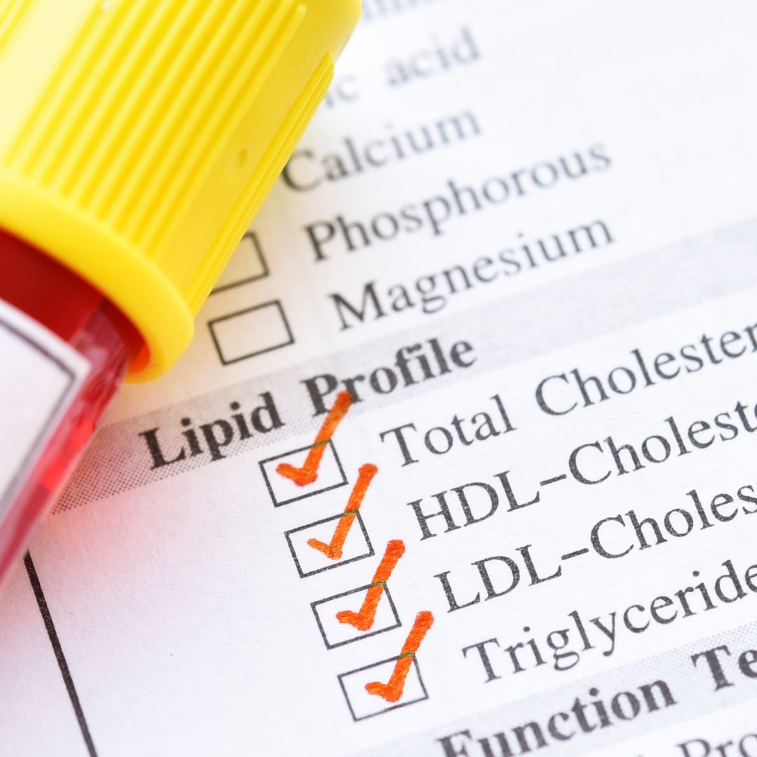 Lipid Marker Image Cholesterol markers on blood test